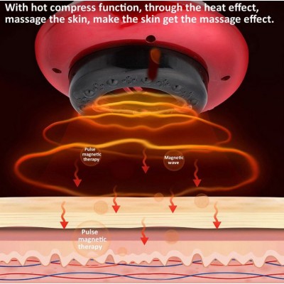 Επαναφορτιζόμενη Θεραπευτική Συσκευή - Βεντούζα για Μασάζ και Λιποδιάλυση - Intelligent Scraping  Cupping