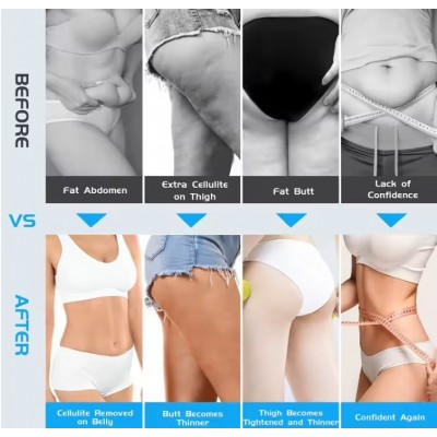 3-in-1 Ηλεκτρική Συσκευή Σμίλευσης και Μασάζ Σώματος με 3 Εναλλάξιμα Μαξιλαράκια 2505GV